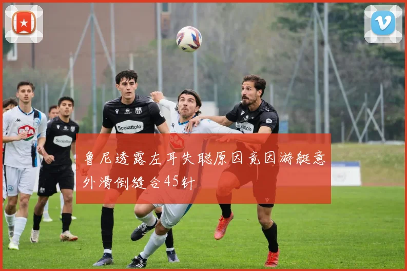 鲁尼透露左耳失聪原因竟因游艇意外滑倒缝合45针